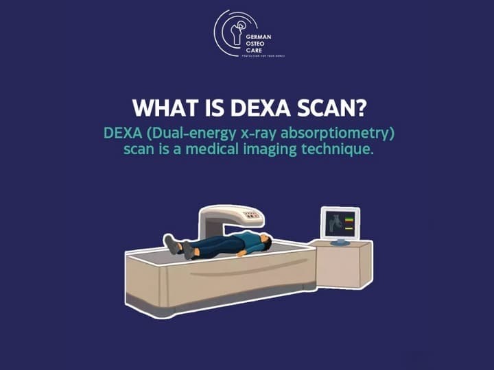 DEXA scan brand campaign creative